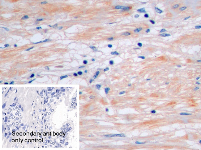 Procollagen I C-Peptide Antibody in Immunohistochemistry (Paraffin) (IHC (P))