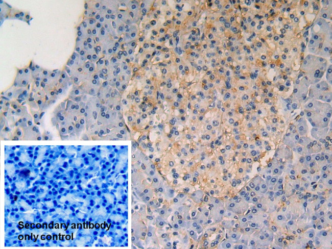 ATF6 Antibody in Immunohistochemistry (Paraffin) (IHC (P))