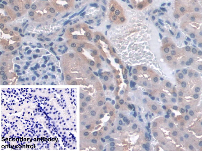 GPX3 Antibody in Immunohistochemistry (Paraffin) (IHC (P))
