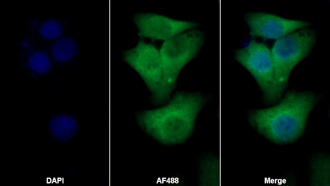 S100A4 Antibody in Immunocytochemistry (ICC/IF)