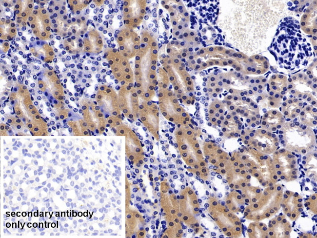 FABP1 Antibody in Immunohistochemistry (Paraffin) (IHC (P))