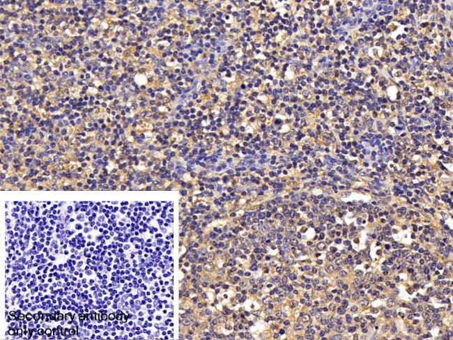 TGF beta-1 Antibody in Immunohistochemistry (Paraffin) (IHC (P))