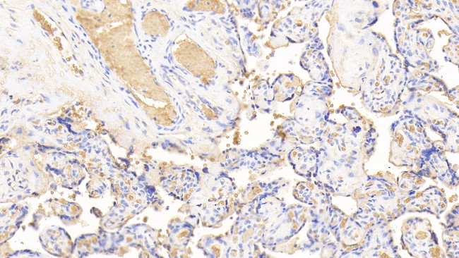 Hemoglobin Antibody in Immunohistochemistry (Paraffin) (IHC (P))