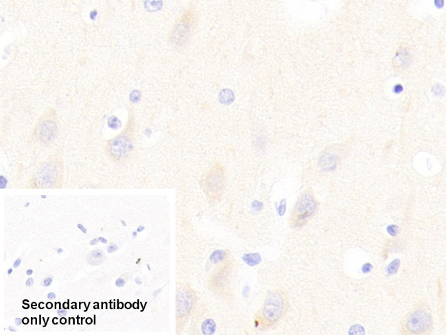 GP6 Antibody in Immunohistochemistry (Paraffin) (IHC (P))