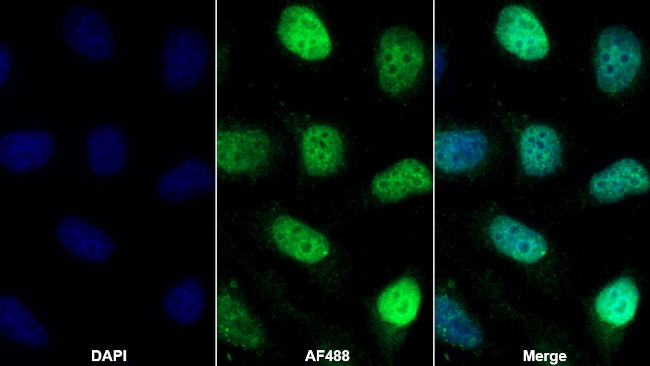Histone H2A.X Antibody in Immunocytochemistry (ICC/IF)