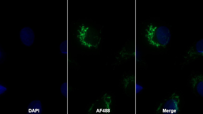 Trypsin Antibody in Immunocytochemistry (ICC/IF)