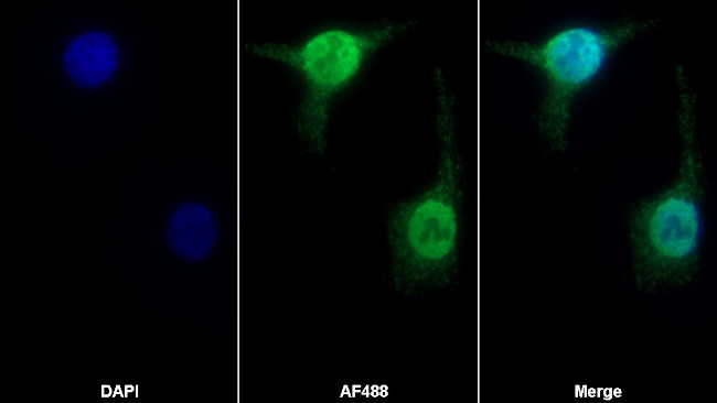 NUP88 Antibody in Immunocytochemistry (ICC/IF)