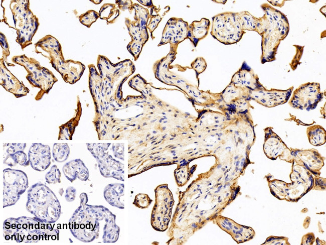 CD200 Antibody in Immunohistochemistry (Paraffin) (IHC (P))