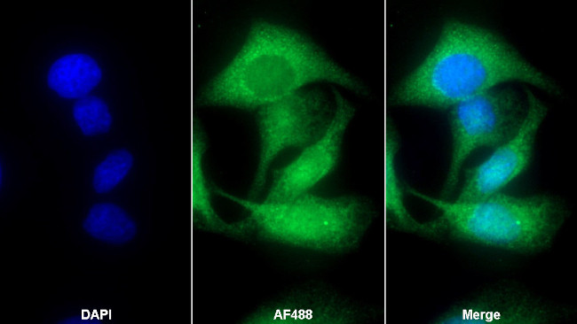 EB1 Antibody in Immunocytochemistry (ICC/IF)