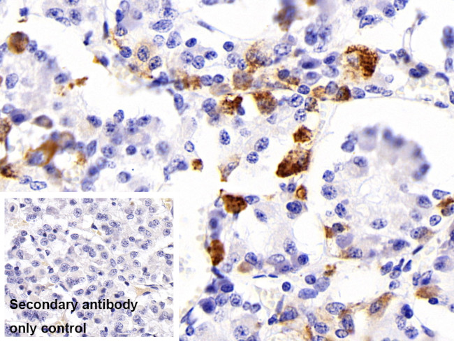 TSH beta Antibody in Immunohistochemistry (Paraffin) (IHC (P))