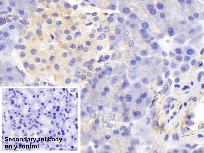 MTCO2 Antibody in Immunohistochemistry (Paraffin) (IHC (P))