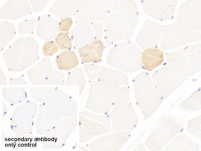 Myosin heavy chain 1 Antibody in Immunohistochemistry (Paraffin) (IHC (P))