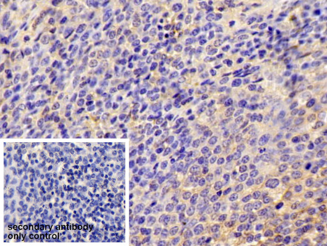 ICAM-1 Antibody in Immunohistochemistry (Paraffin) (IHC (P))