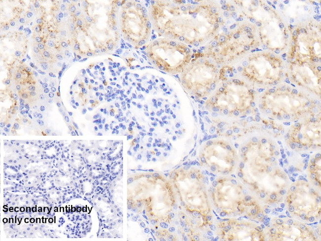Hemoglobin Antibody in Immunohistochemistry (Paraffin) (IHC (P))