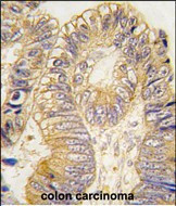 CLIC5 Antibody in Immunohistochemistry (Paraffin) (IHC (P))