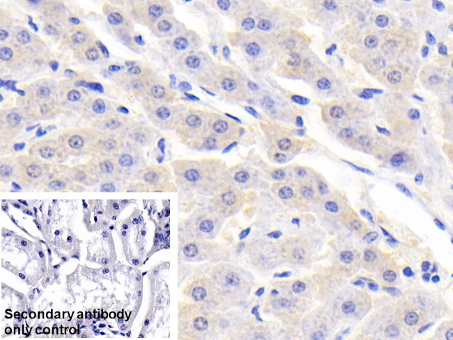 RBP5 Antibody in Immunohistochemistry (Paraffin) (IHC (P))
