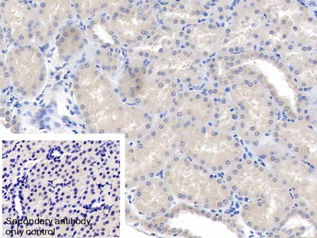 ANGPTL1 Antibody in Immunohistochemistry (Paraffin) (IHC (P))