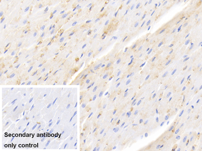 Hemoglobin Antibody in Immunohistochemistry (Paraffin) (IHC (P))