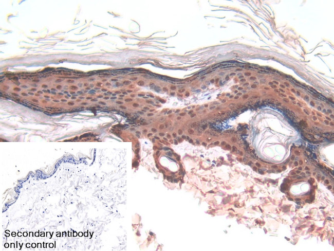 Galectin 7 Antibody in Immunohistochemistry (Paraffin) (IHC (P))