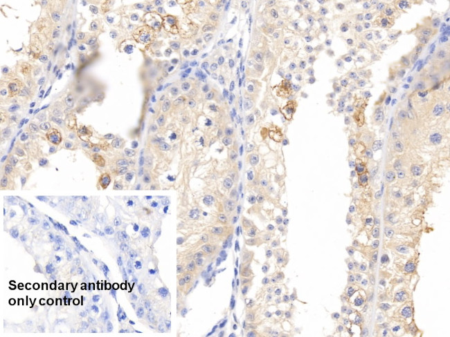 Pleiotrophin Antibody in Immunohistochemistry (Paraffin) (IHC (P))