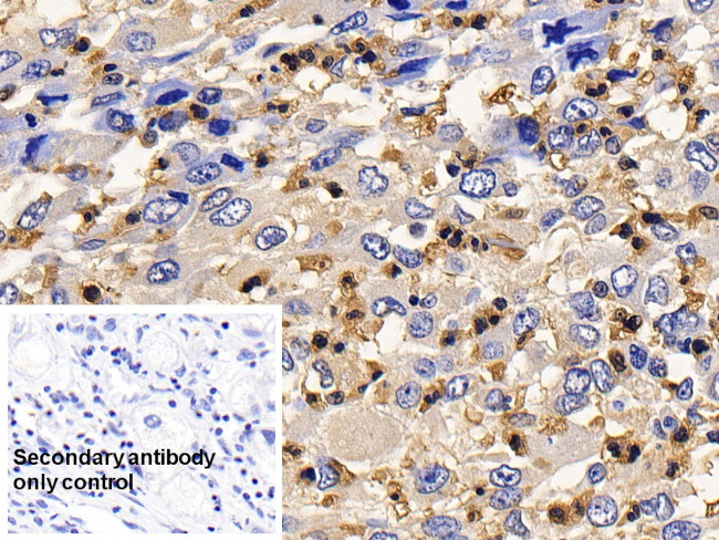 IL13RA2 Antibody in Immunohistochemistry (Paraffin) (IHC (P))
