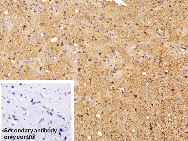 S100B Antibody in Immunohistochemistry (Paraffin) (IHC (P))