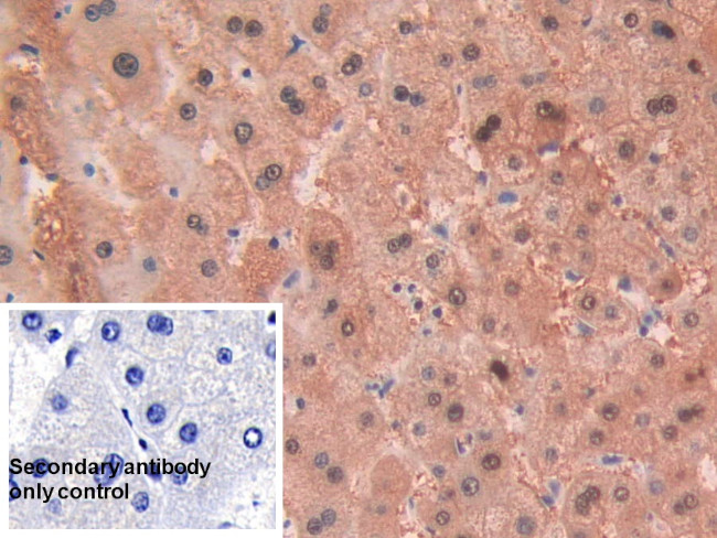 Alcohol Dehydrogenase 1A Antibody in Immunohistochemistry (Paraffin) (IHC (P))