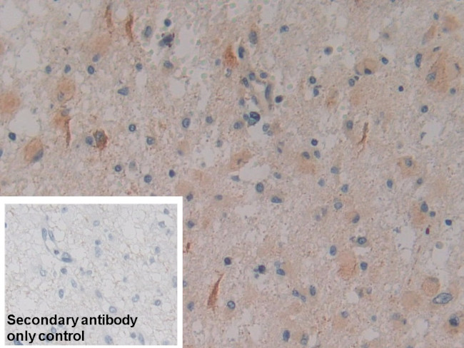 PKC mu Antibody in Immunohistochemistry (Paraffin) (IHC (P))