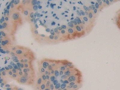 LCN8 Antibody in Immunohistochemistry (Paraffin) (IHC (P))