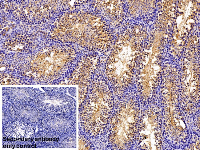 NME5 Antibody in Immunohistochemistry (Paraffin) (IHC (P))