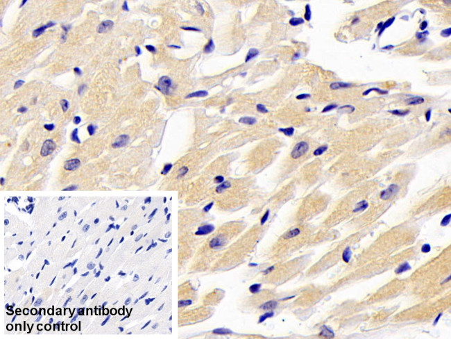 ARK5 Antibody in Immunohistochemistry (Paraffin) (IHC (P))