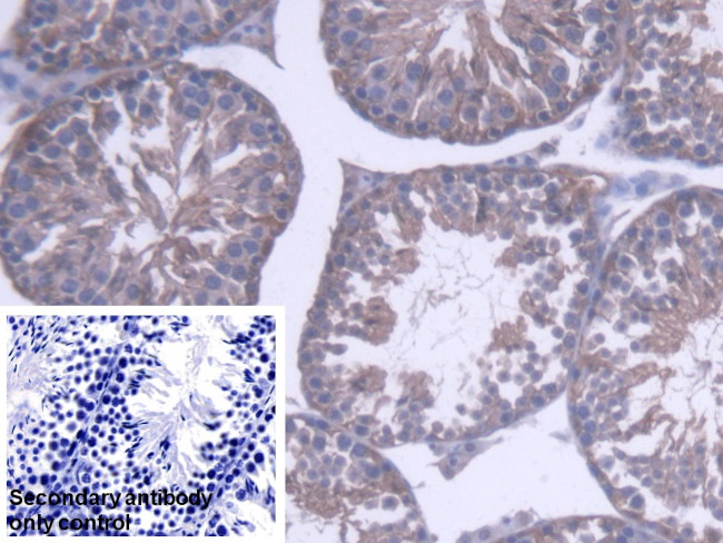 PEBP1 Antibody in Immunohistochemistry (Paraffin) (IHC (P))