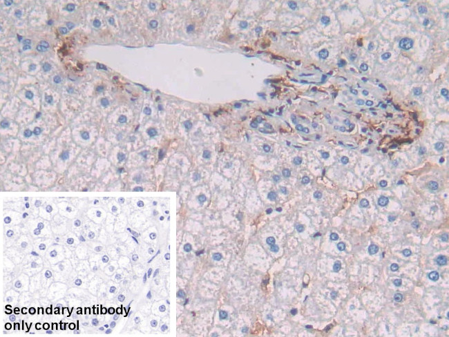 HLA-DRB1 Antibody in Immunohistochemistry (Paraffin) (IHC (P))