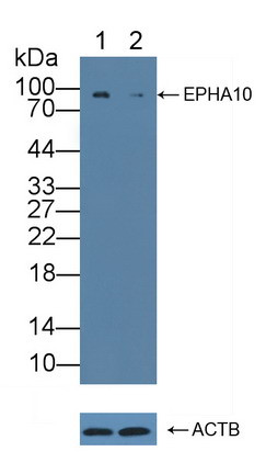 EphA10 Antibody in Western Blot (WB)