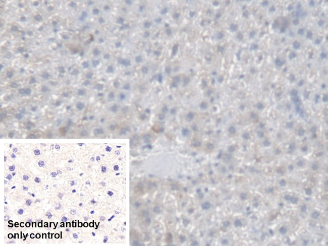 CES1 Antibody in Immunohistochemistry (Paraffin) (IHC (P))