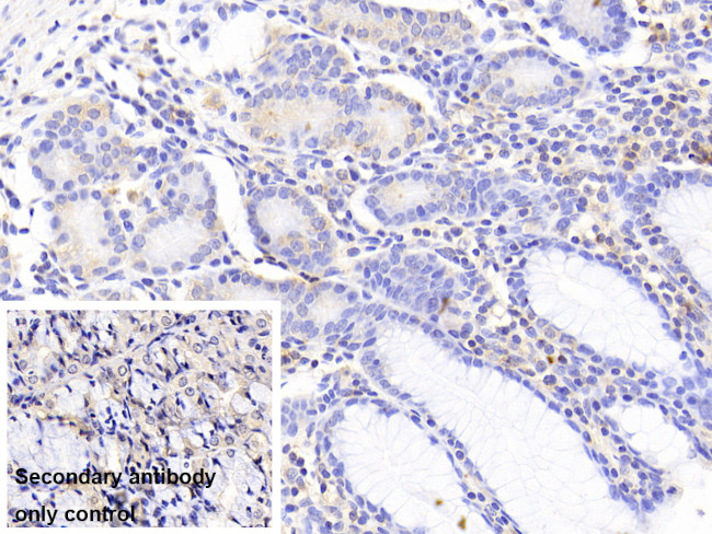 NUTF2 Antibody in Immunohistochemistry (Paraffin) (IHC (P))