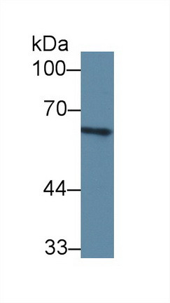C8A Antibody in Western Blot (WB)
