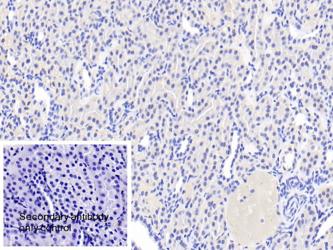 ACSM1 Antibody in Immunohistochemistry (Paraffin) (IHC (P))