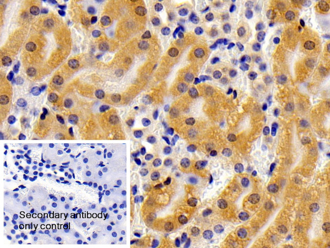 CPPED1 Antibody in Immunohistochemistry (Paraffin) (IHC (P))