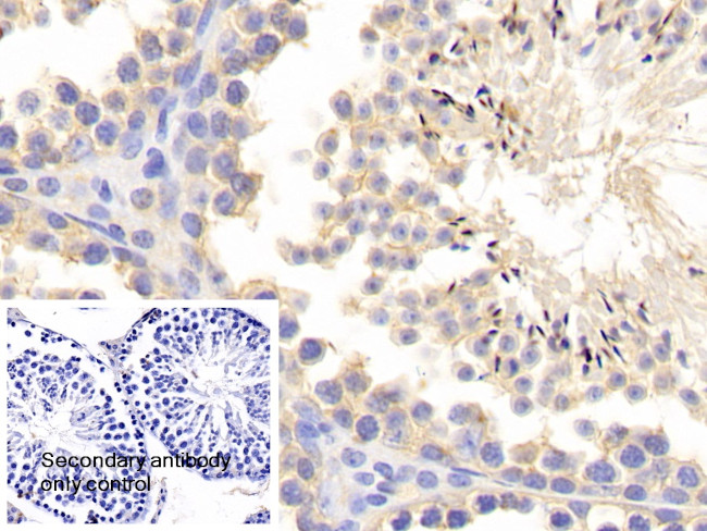 MMP1 Antibody in Immunohistochemistry (Paraffin) (IHC (P))