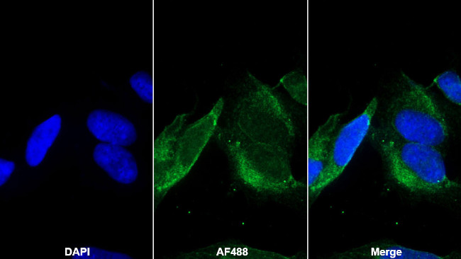 SEMA5B Antibody in Immunocytochemistry (ICC/IF)