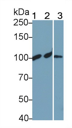 Complement C4a Antibody in Western Blot (WB)