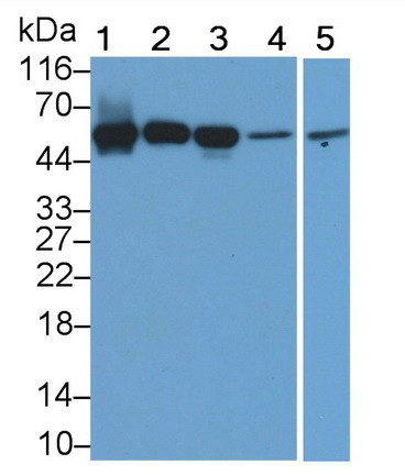 Acid Phosphatase 2 Antibody in Western Blot (WB)
