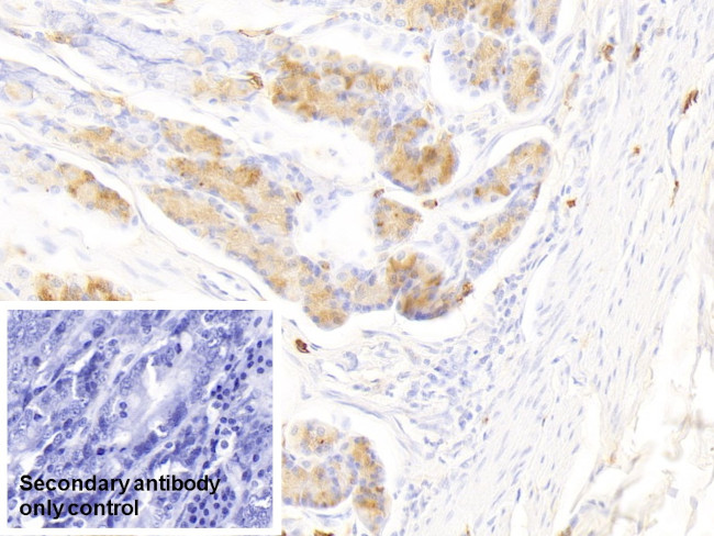 Tryptase Antibody in Immunohistochemistry (Paraffin) (IHC (P))