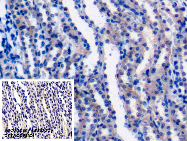 LAD1 Antibody in Immunohistochemistry (Paraffin) (IHC (P))