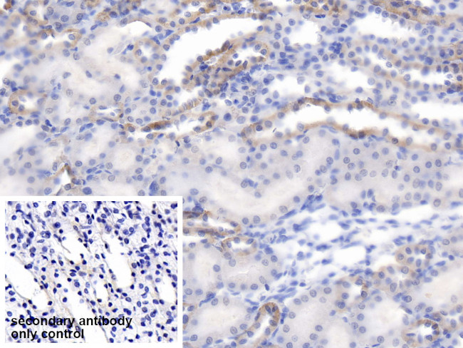 Synphilin 1 Antibody in Immunohistochemistry (Paraffin) (IHC (P))