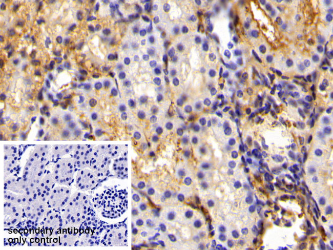 Fibrinogen Antibody in Immunohistochemistry (Paraffin) (IHC (P))