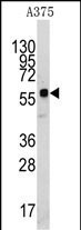 KREMEN1 Antibody in Western Blot (WB)