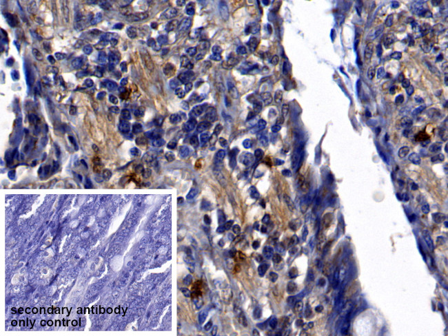 Neutrophil elastase Antibody in Immunohistochemistry (Paraffin) (IHC (P))