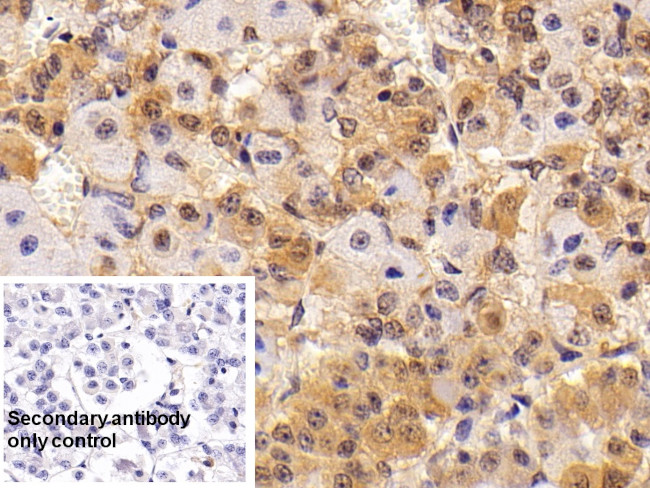 TSH beta Antibody in Immunohistochemistry (Paraffin) (IHC (P))